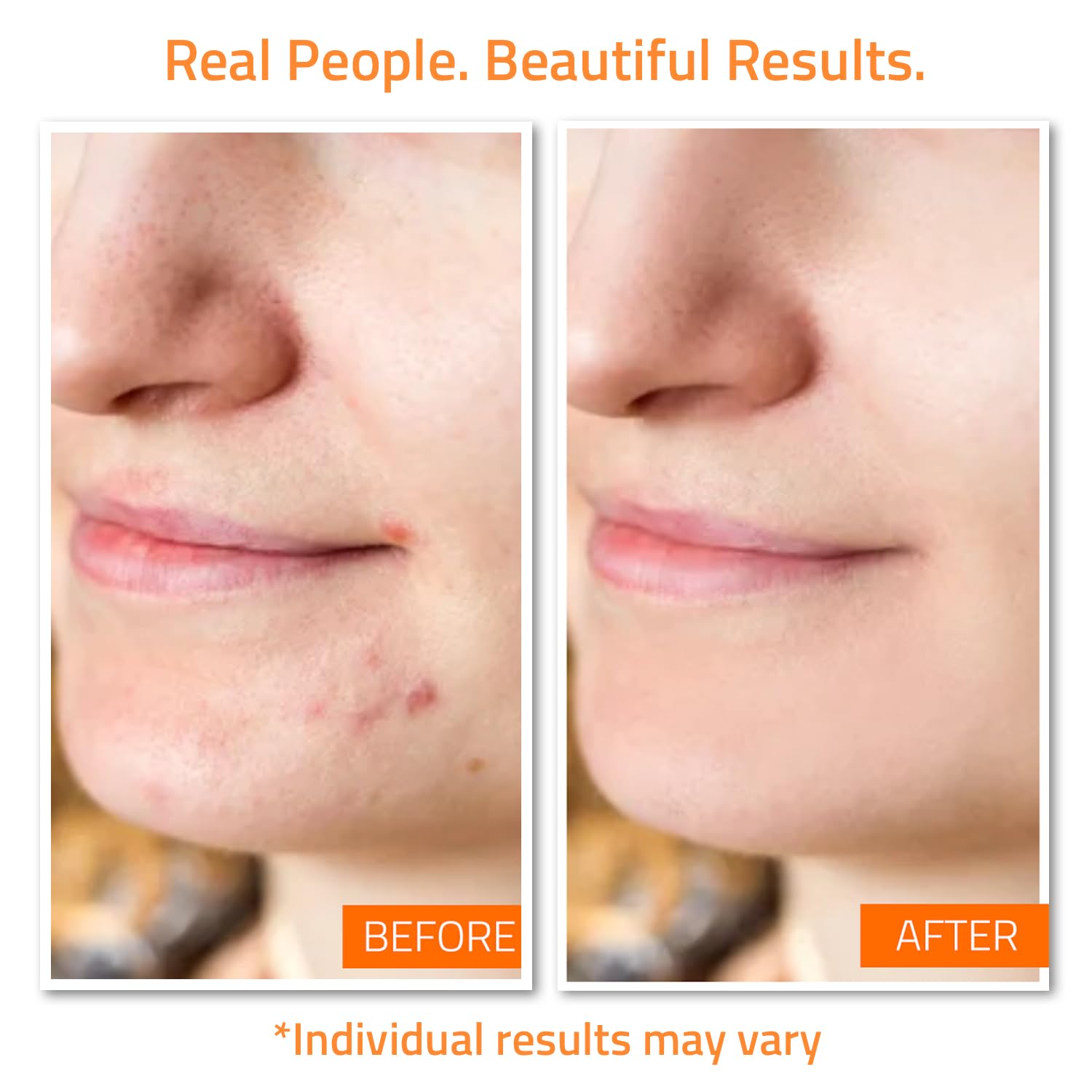Foto 4 pulgar | Set De Cuidado Facial, Tónico, Sérum Y Crema Con Vitamina C Yeouth - Venta Internacional.