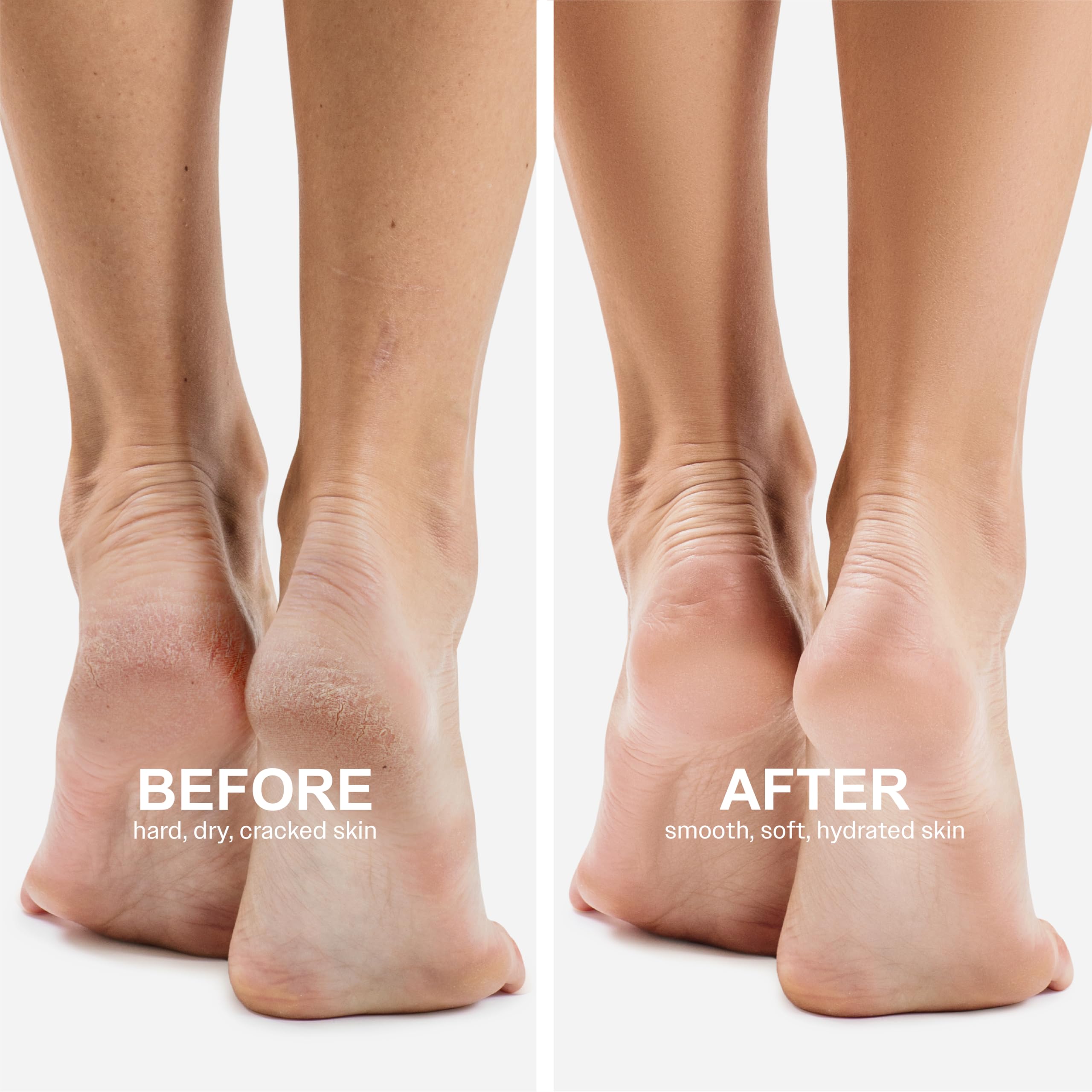Foto 7 pulgar | Mascarilla Para Pies Innerest Original Derma Beauty, 6 Pares De Aceite De Aguacate - Venta Internacional.