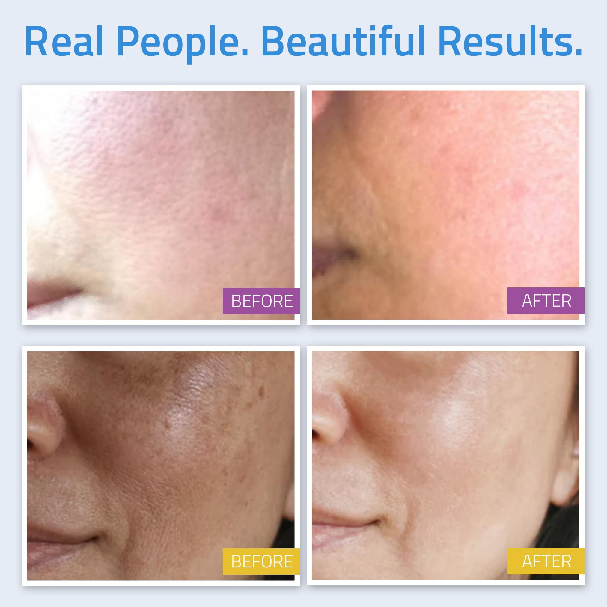 Foto 5 | Set De Cuidado De La Piel Yeouth, Sérum De Retinol Con Ácido Hialurónico, 8 Piezas - Venta Internacional.