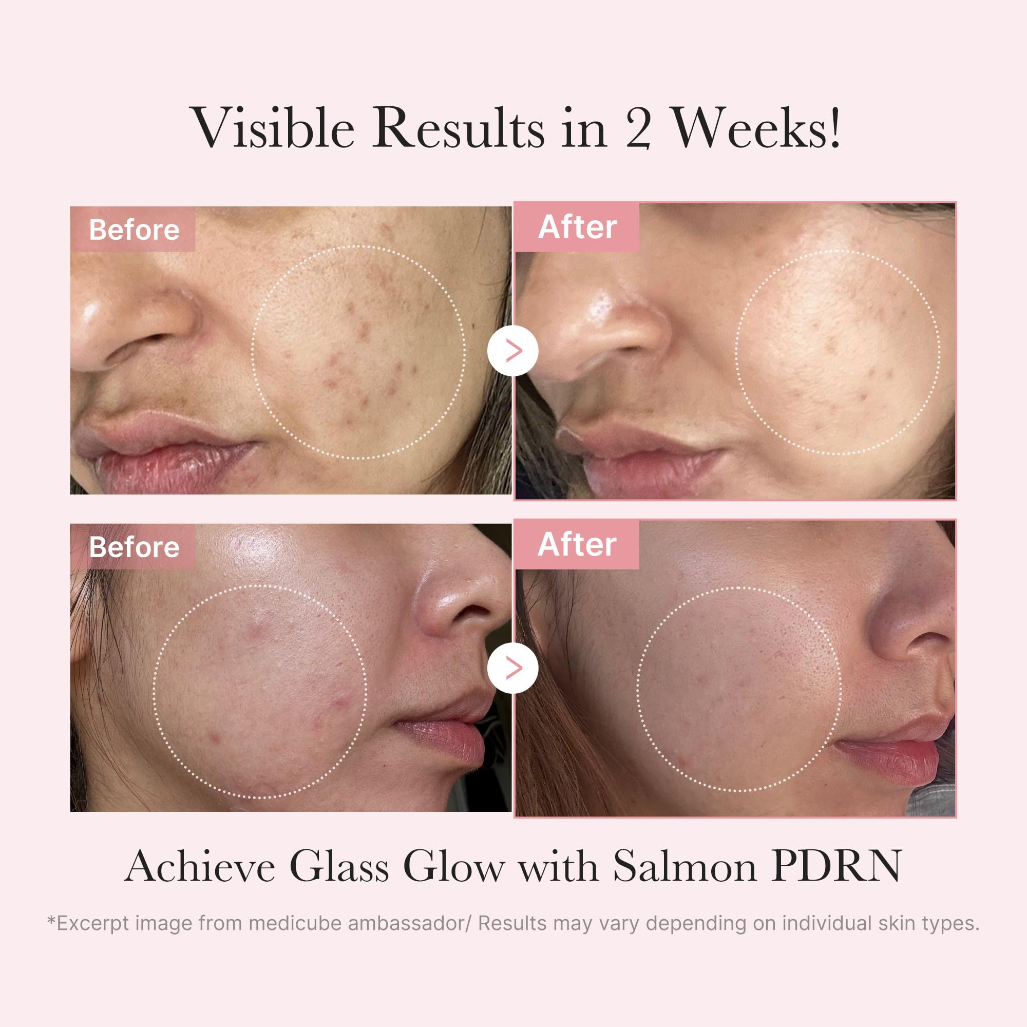Foto 4 pulgar | Set De Cuidado De La Piel Medicube Salmon Dna Pdrn Con Tónico, Sérum Y Mascarilla - Venta Internacional.