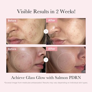 Foto 3 | Set De Cuidado De La Piel Medicube Salmon Dna Pdrn Con Tónico, Sérum Y Mascarilla - Venta Internacional.