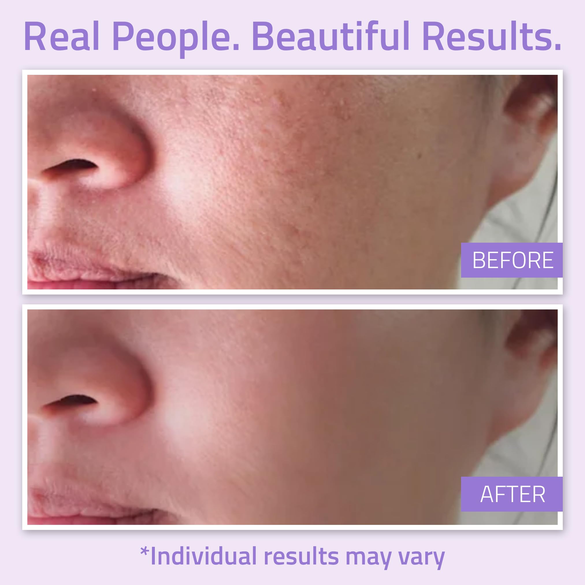 Foto 5 pulgar | Tónico Facial Balanceado Yeouth 100 ml-Venta Internacional