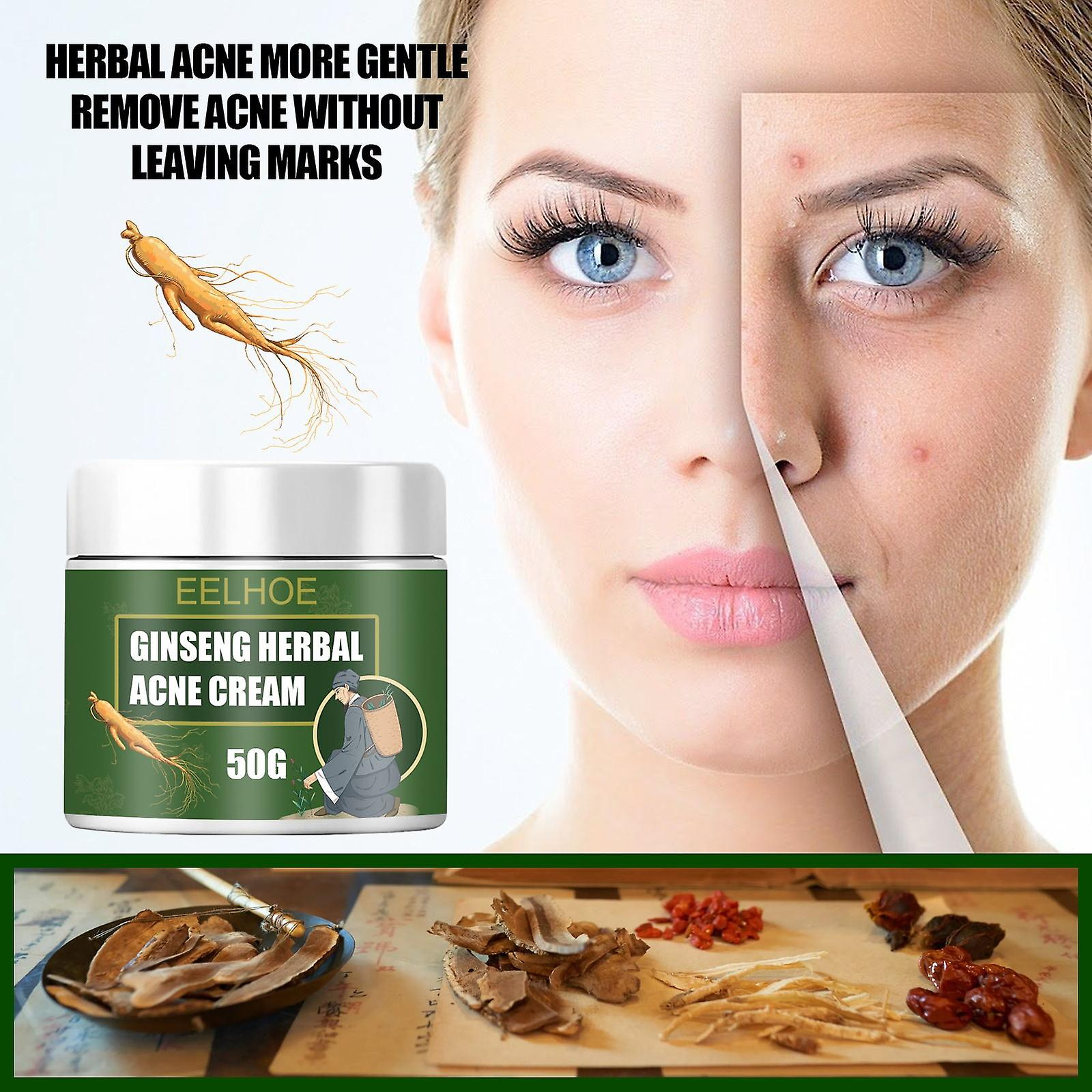 Foto 3 pulgar | Crema Para El Acné Huoguo Ginseng Herbal Desalt  Reparadora De Cicatrices  10-50 G - Venta Internacional.