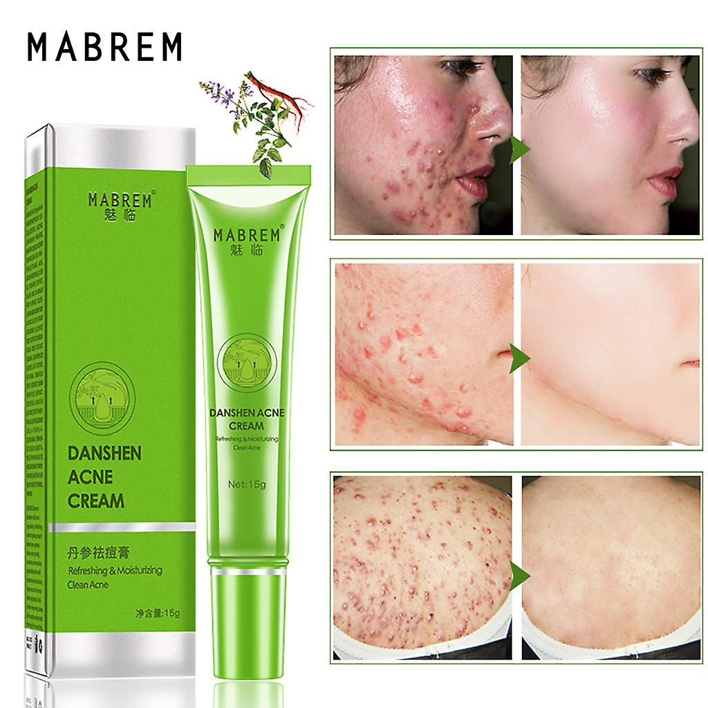 Foto 3 pulgar | Crema Para El Acné Mabrem Repair Extract  Elimina Las Cicatrices Del Acné  15 G - Venta Internacional.