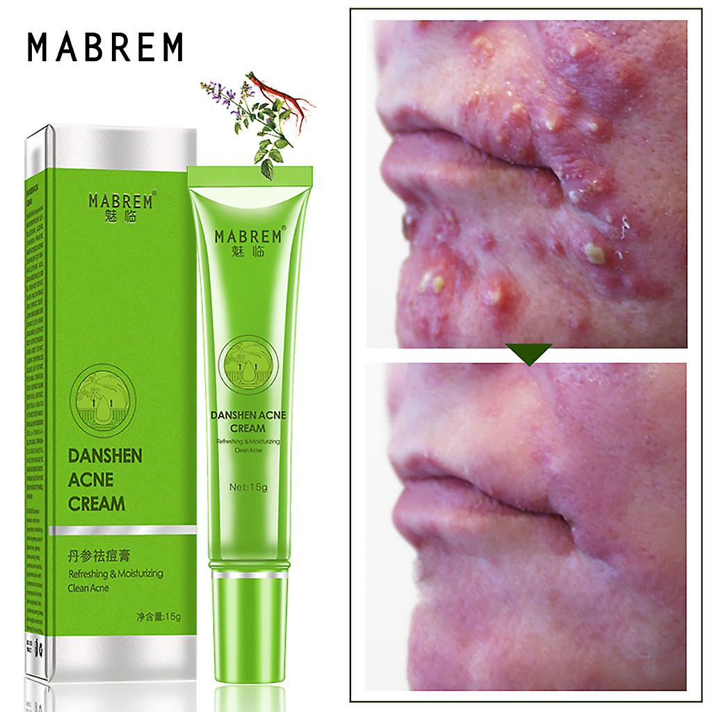 Foto 5 pulgar | Crema Para El Acné Mabrem Repair Extract  Elimina Las Cicatrices Del Acné  15 G - Venta Internacional.