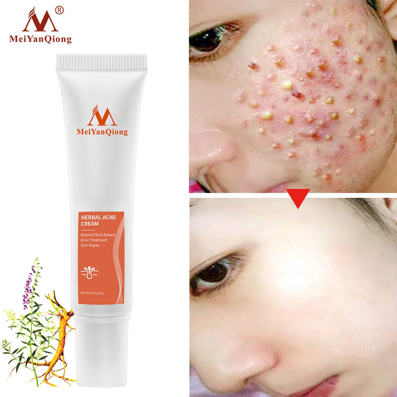Foto 4 | Crema Iluminadora Huoguo Beauty Cream Delicate Skin Poros - Venta Internacional.