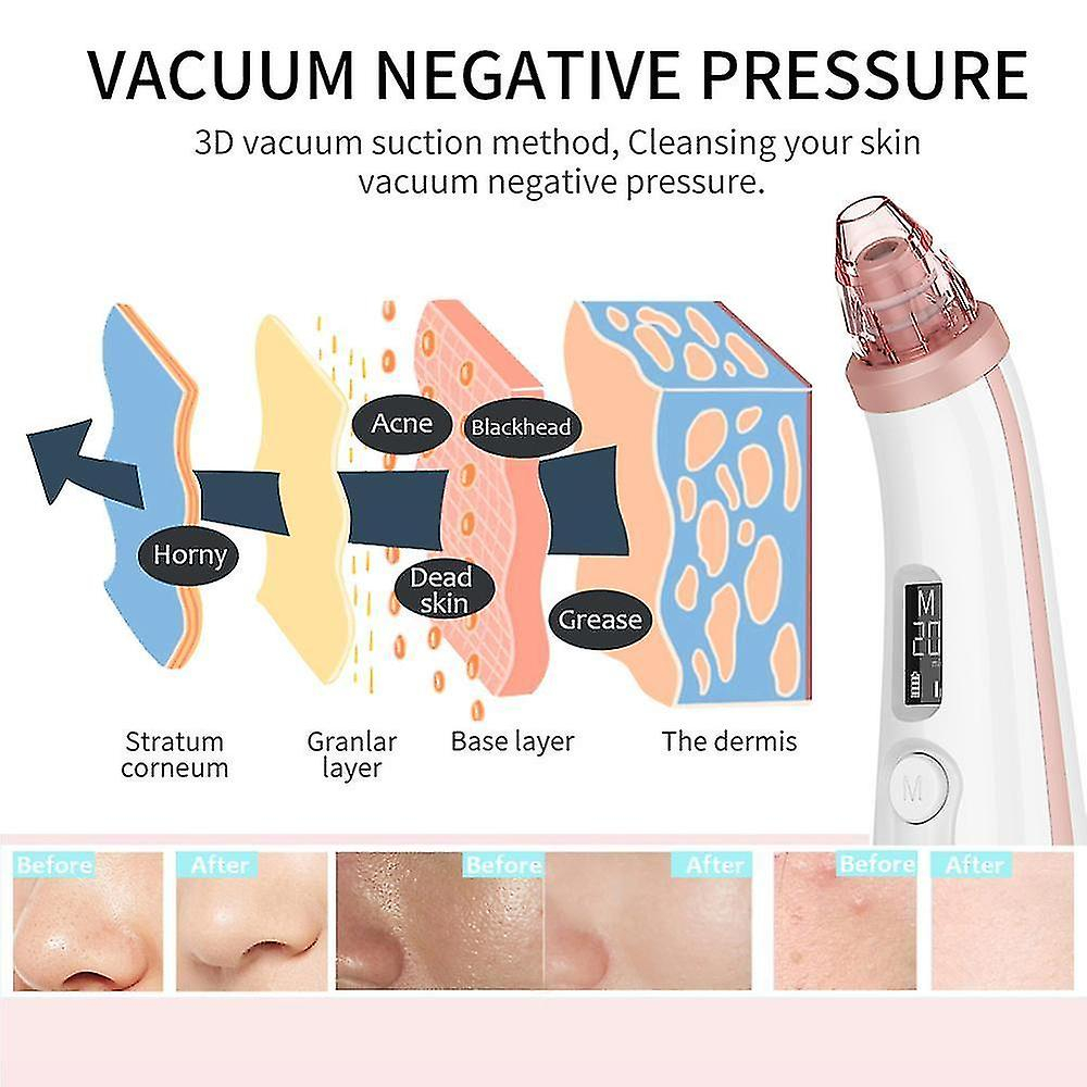 Foto 4 pulgar | Limpiador Facial  Eliminador De Puntos Negros  Poros Al Vacío  Eliminación Del Acné - Venta Internacional.