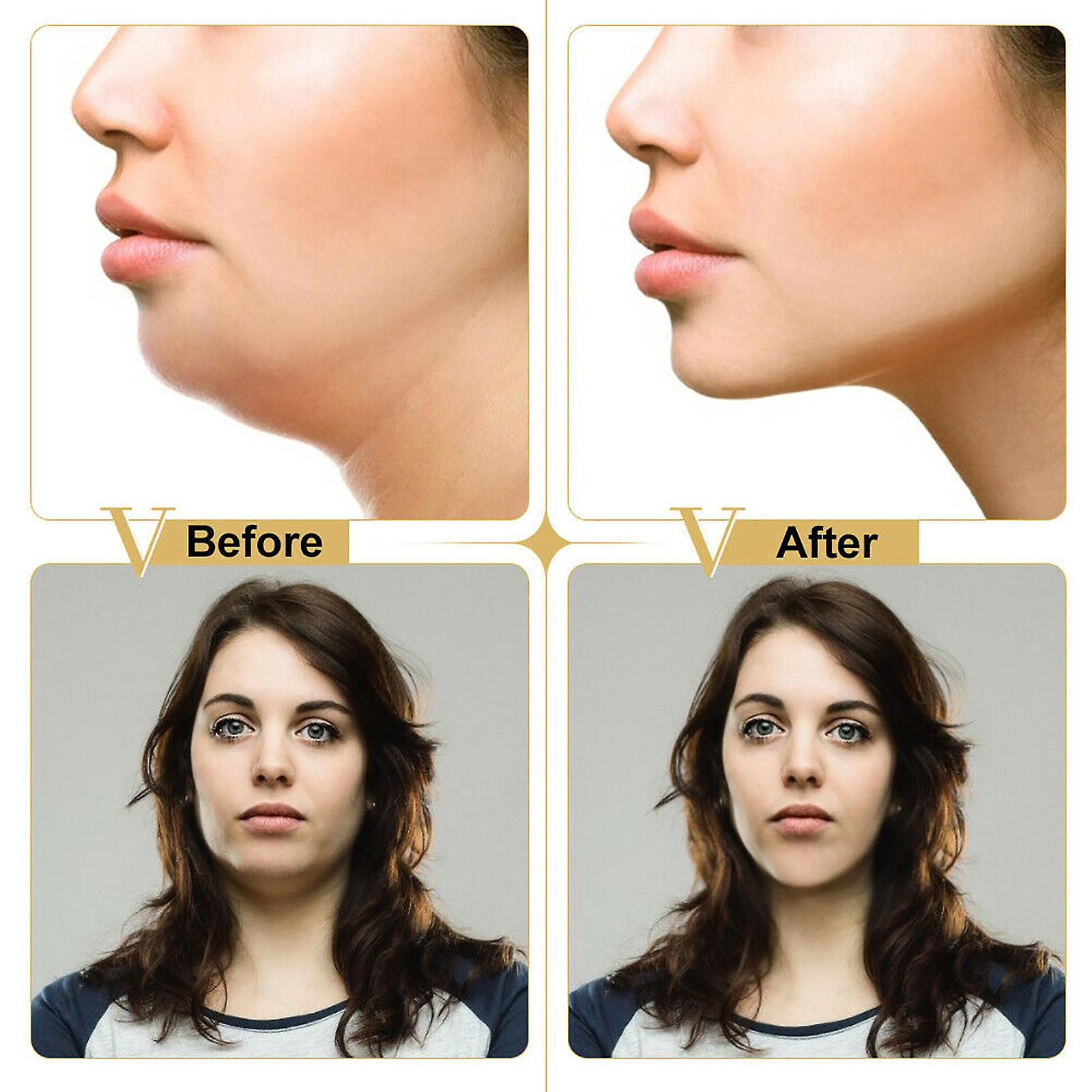 Foto 5 pulgar | Mascarilla Adelgazante Facial Huoguo  En Forma De V  Que Reafirma La Quema De Grasa - Venta Internacional.