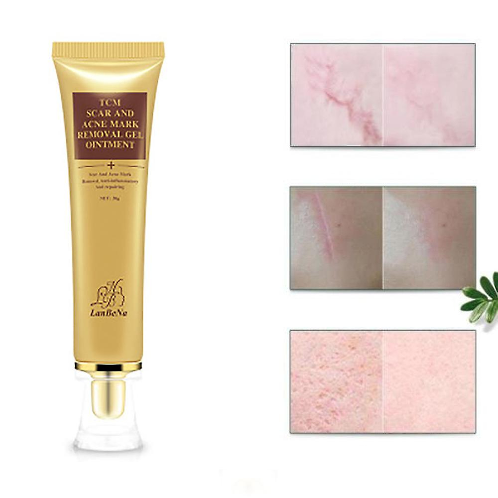 Foto 4 | Crema De Eliminación De Cicatrices De Acné Huoguo Skin Repair Face 30 Ml - Venta Internacional.