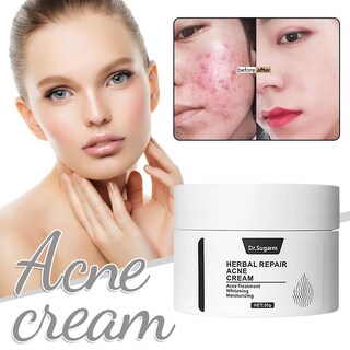 Foto 2 | Crema De Eliminación De Cicatrices De Acné Huoguo Para Aceite Facial Y Agua Bala - Venta Internacional.
