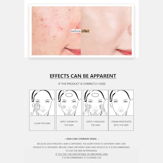 Foto 5 | Crema De Eliminación De Cicatrices De Acné Huoguo Para Aceite Facial Y Agua Bala - Venta Internacional.