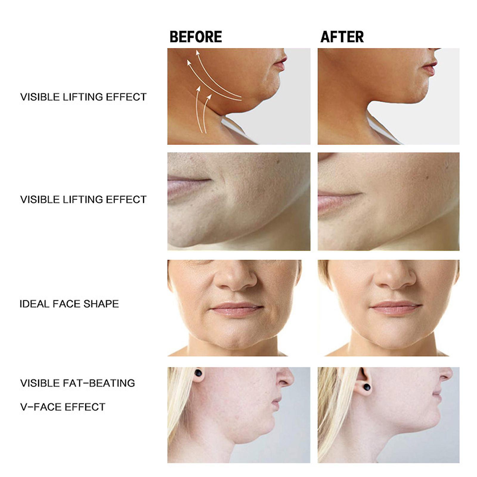Foto 4 pulgar | Crema Facial Huoguo V Lift Muscle Double Chin - Venta Internacional.