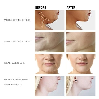 Foto 3 | Crema Facial Huoguo V Lift Muscle Double Chin - Venta Internacional.