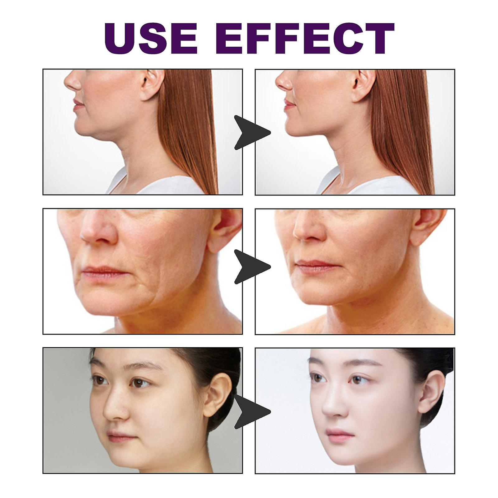 Foto 4 | Pegatina Facial Huoguo V Face Sticker Mate Invisible - Venta Internacional.