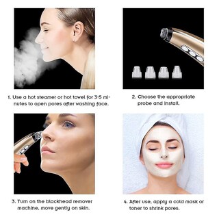 Foto 3 | Máquina Limpiadora Facial Para Eliminar Puntos Negros Y Aspiradora De Acné - Venta Internacional.