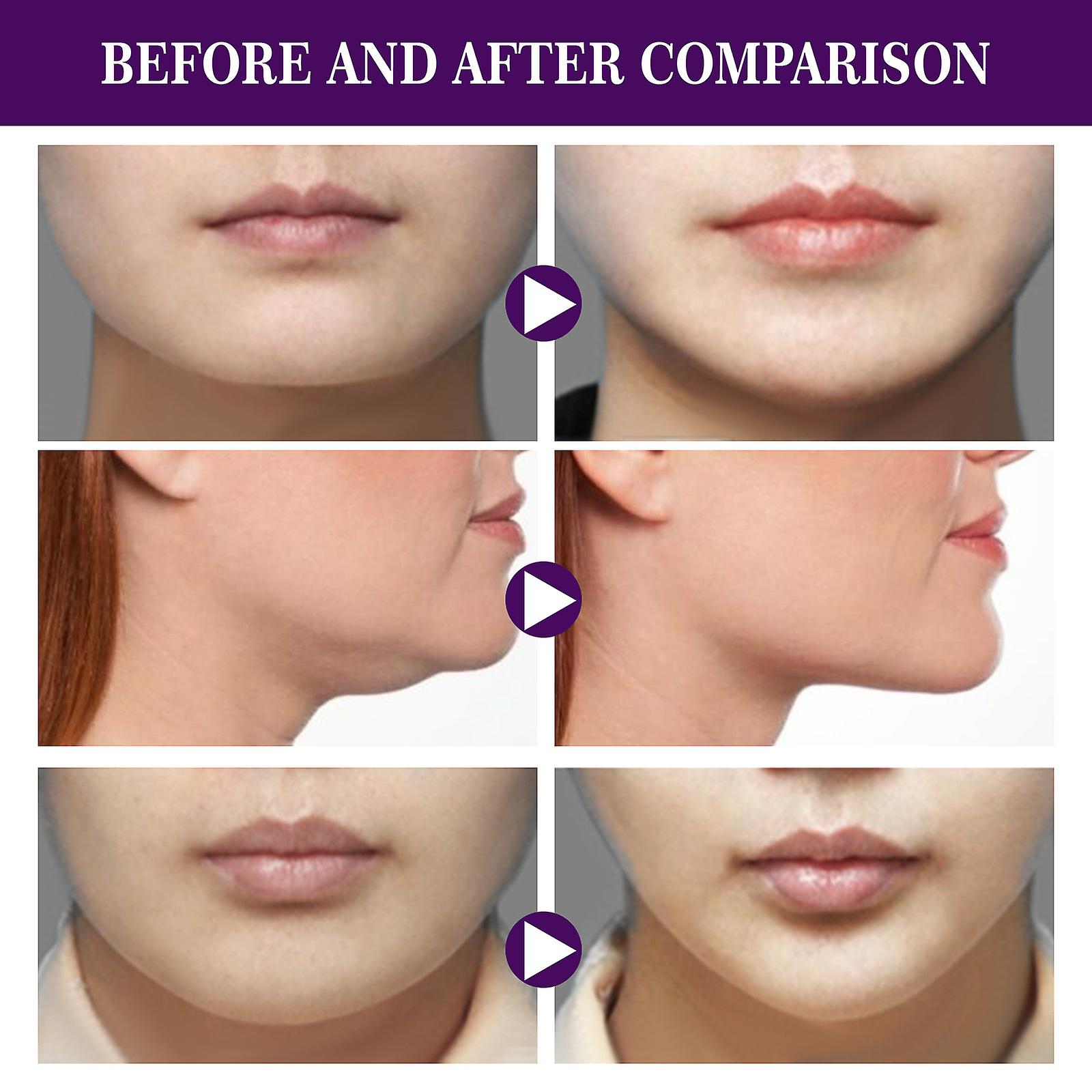 Foto 5 pulgar | Cinta De Estiramiento Facial Huoguo Elasticidad Ultrafina E Impermeable - Venta Internacional.