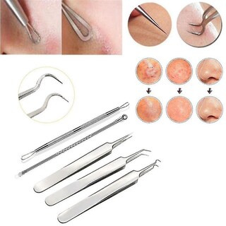 Foto 2 | Juego De Utensilios De Cocina Huoguo Herramienta Para Eliminar El Acné De Acero Inoxidable 5 Pieza - Venta Interna