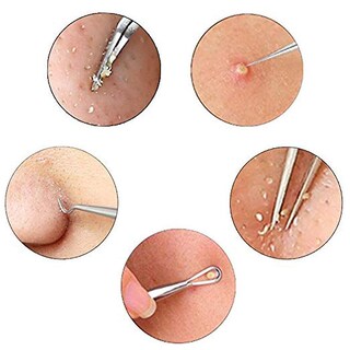 Foto 3 | Juego De Removedores De Espinillas Para Acné Facial De Acero Inoxidable 7 Piezas - Venta Internacional.