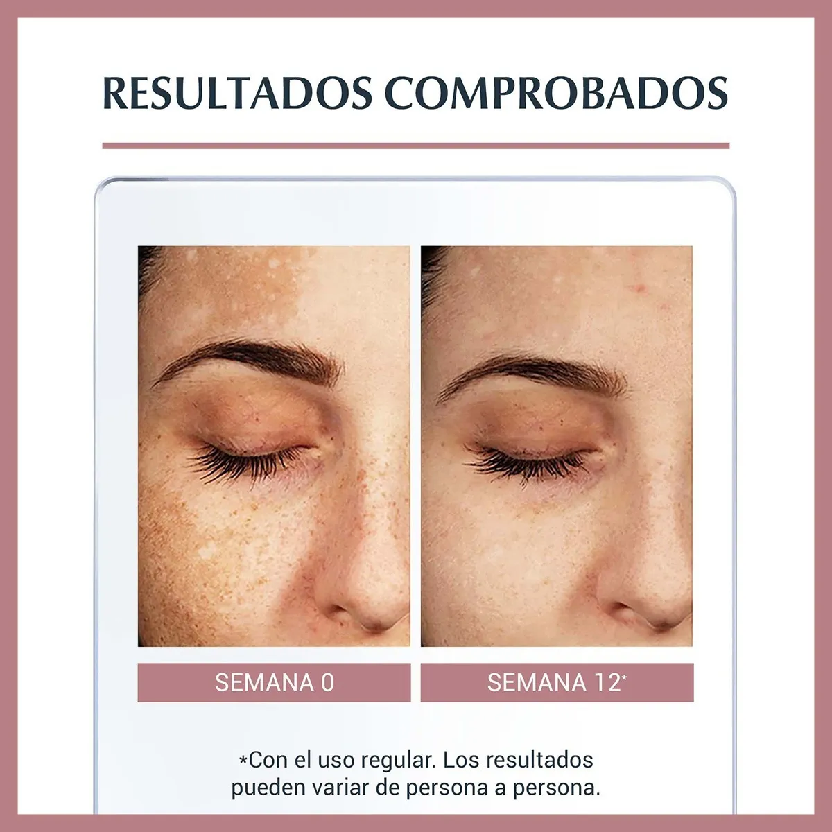 Foto 4 pulgar | Crema Facial Antimanchas de Noche Eucerin Anti Pigment 50ml