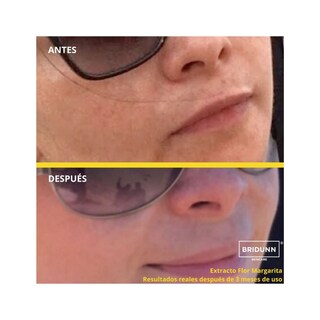Foto 5 | Suero Despigmentante y Crema Antiarrugas Bridunn Skincare