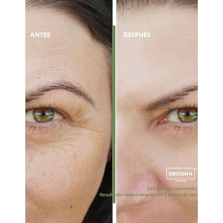 Foto 7 | Suero Despigmentante y Crema Antiarrugas Bridunn Skincare