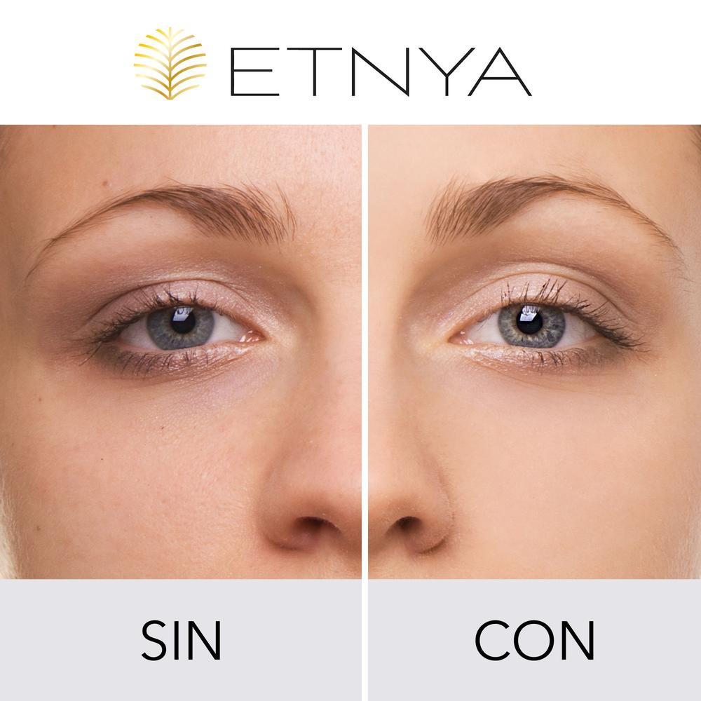 Foto 6 | Botox Reparación Natural Efecto Instantáneo Duración 6 Hrs