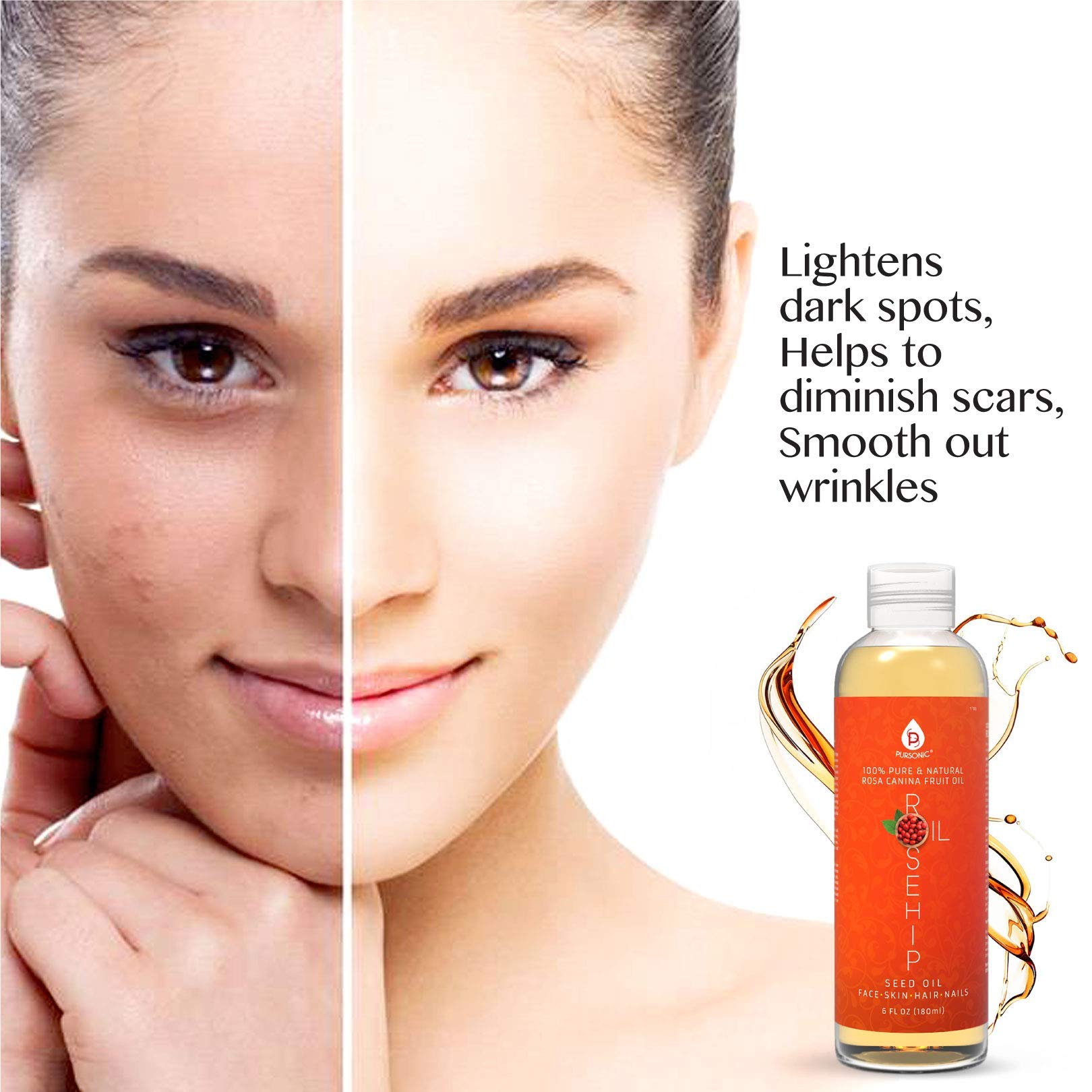 Foto 6 pulgar | Aceite De Rosa Mosqueta Pursonic 180 Ml Para Rostro, Uñas, Cabello Y Piel - Venta Internacional.