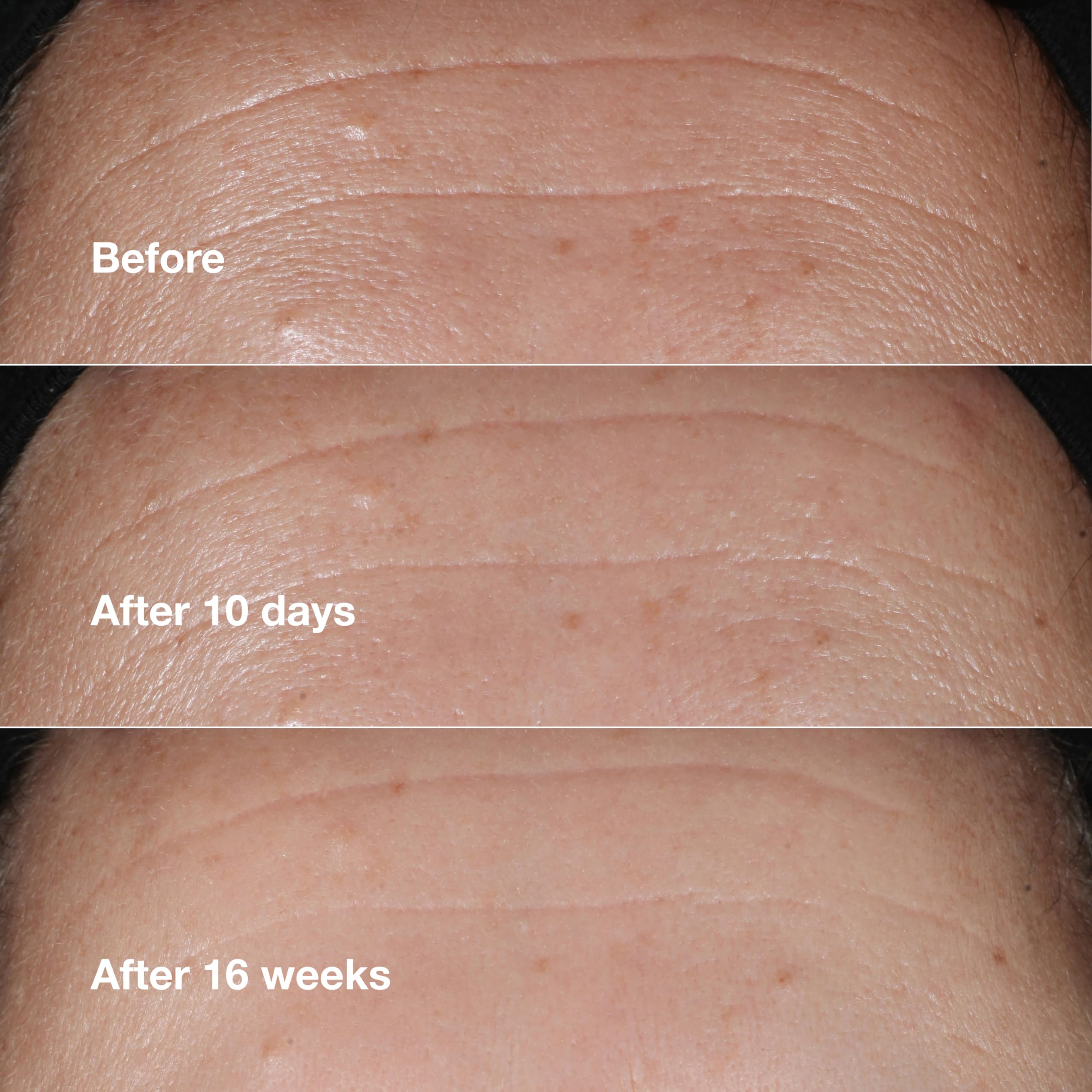 Foto 5 pulgar | Serum Clinique Smart Clinical Repair Arrugas, 10 Ml - Venta Internacional.