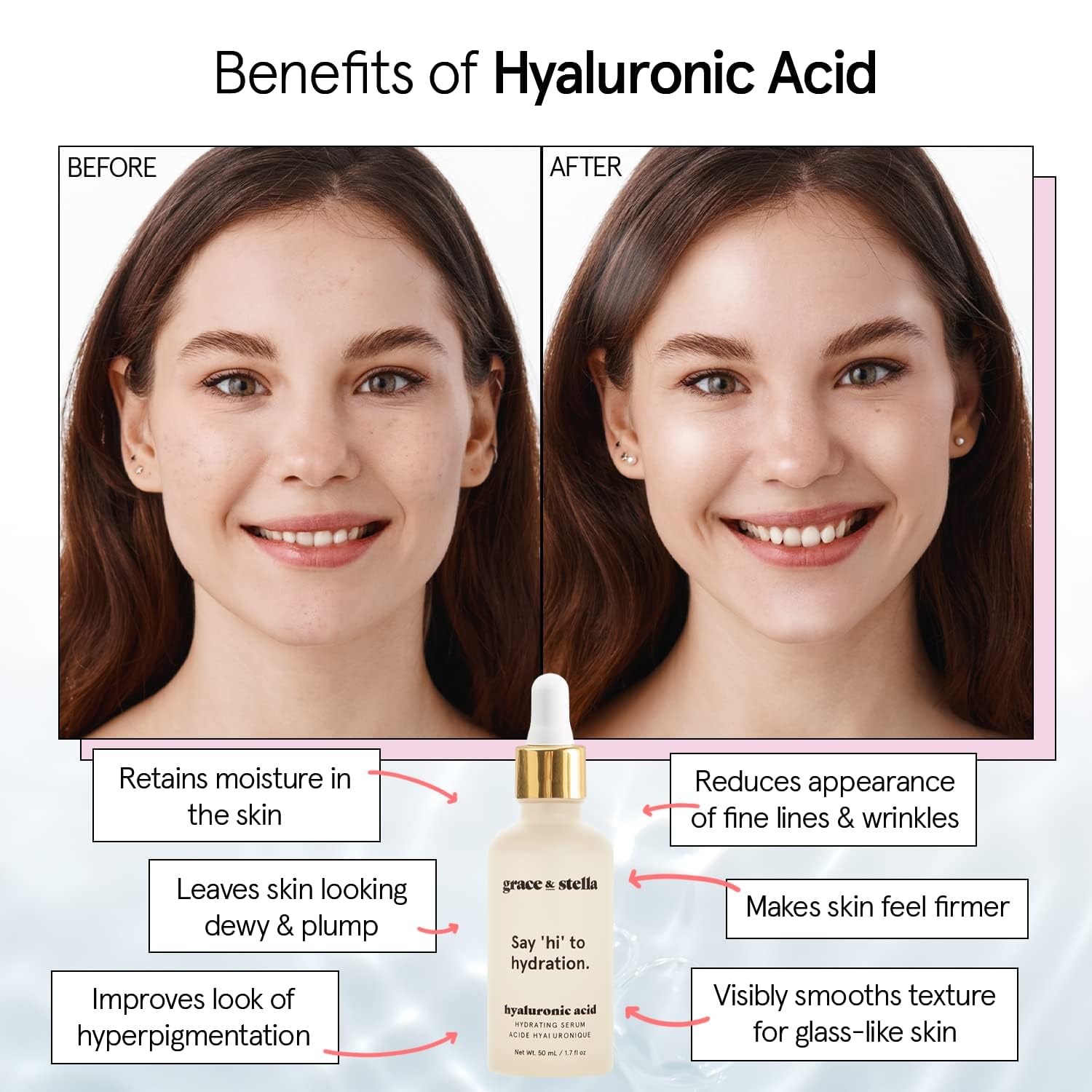 Foto 3 | Serum Grace & Stella Ácido Hialurónico De 10 Ml Para Rostro Antienvejecimiento - Venta Internacional.