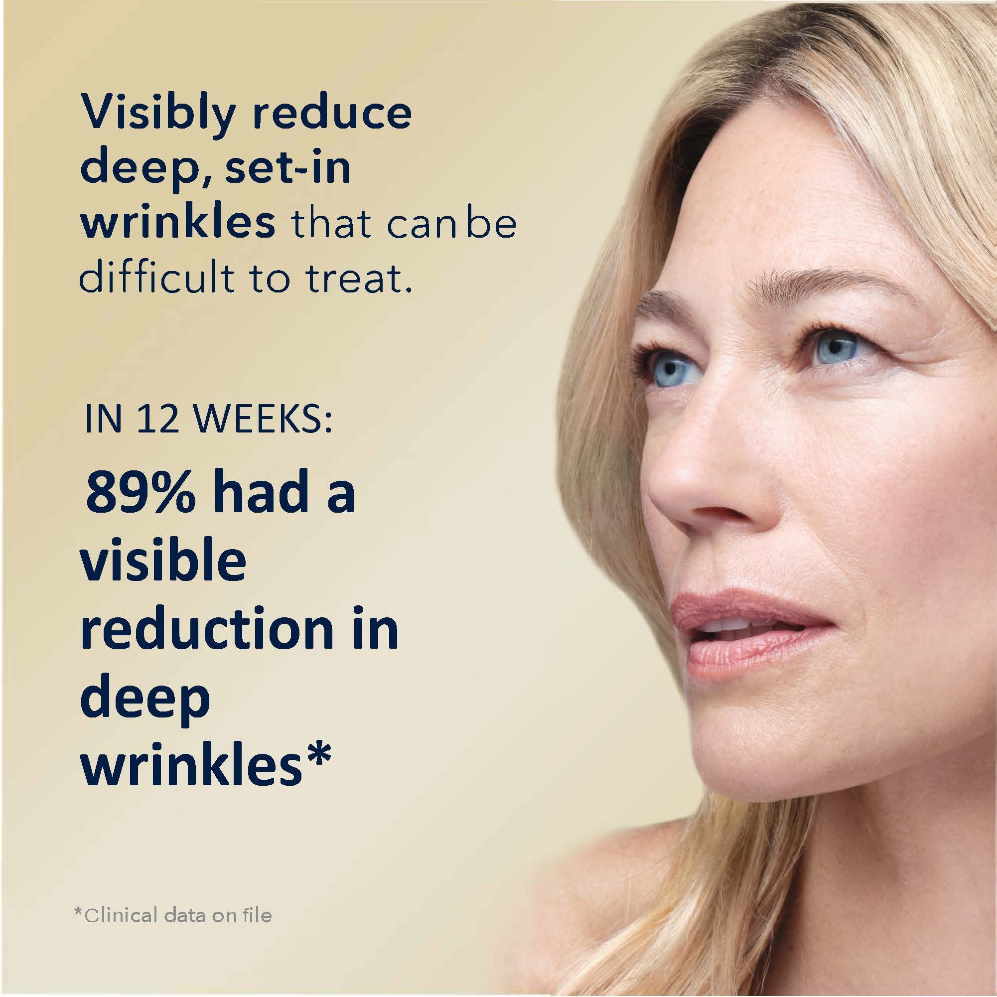 Foto 3 pulgar | Sérum Roc Retinol Correxion Deep Wrinkle 30 Ml Con Ácido Ascórbico - Venta Internacional.