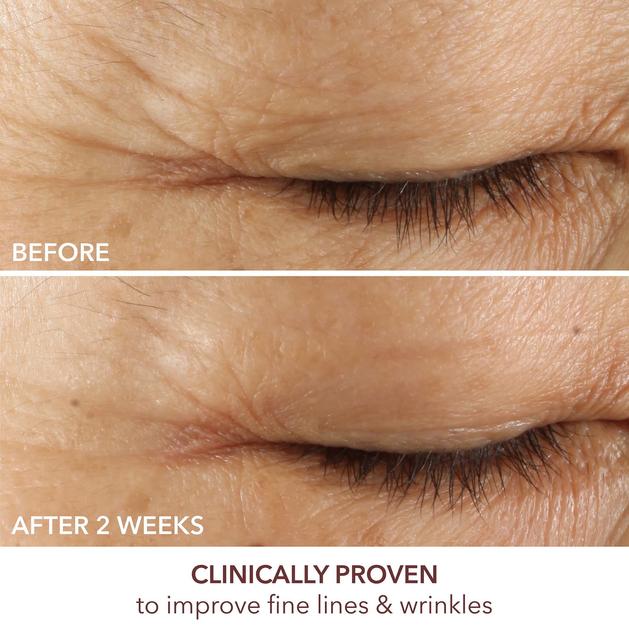 Foto 6 pulgar | Sérum Para Ojos Dr. Dennis Gross Advanced Retinol + Ferulic 15 Ml - Venta Internacional.