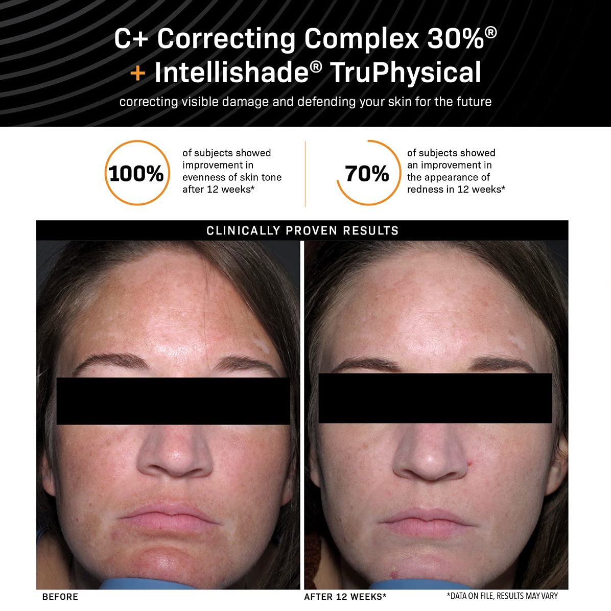 Foto 4 | Complejo Corrector Serum Revision Skincare C+ 30% 30 Ml - Venta Internacional.