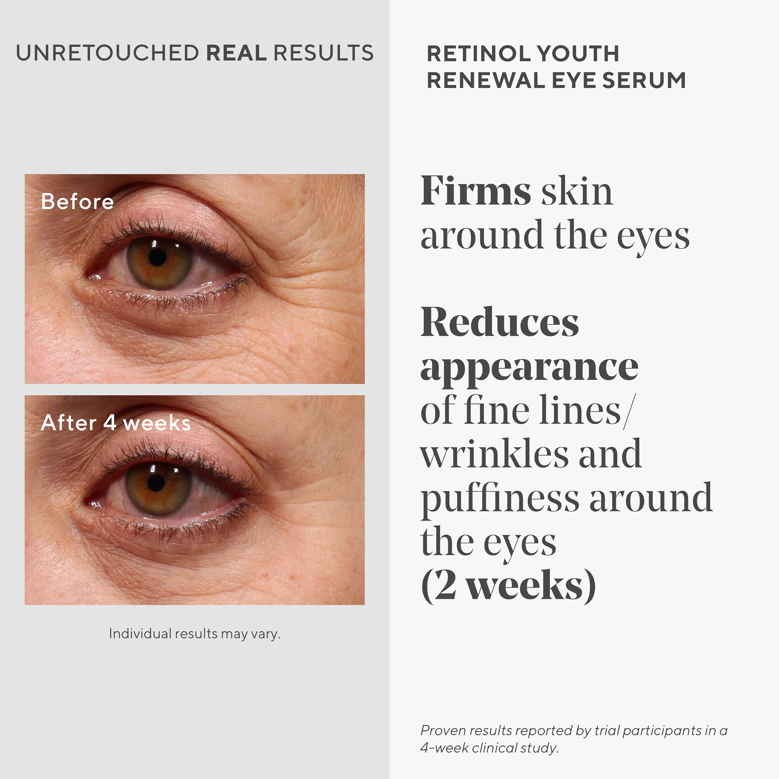 Foto 4 pulgar | Sérum Para Ojos Murad Retinol Youth Renewal, 15 Ml, Visiblemente Mejora - Venta Internacional.