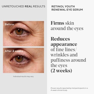 Foto 3 | Sérum Para Ojos Murad Retinol Youth Renewal, 15 Ml, Visiblemente Mejora - Venta Internacional.