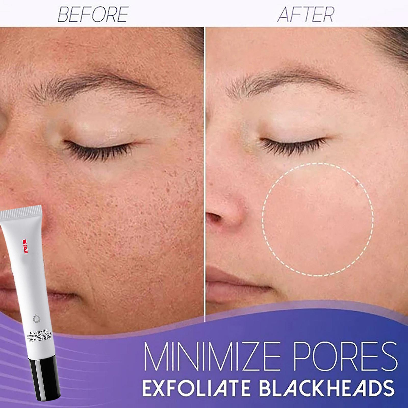 Foto 3 | Crema Hidratante Reafirmante Blanqueadora Huoguo Poreless 20 Ml - Venta Internacional.