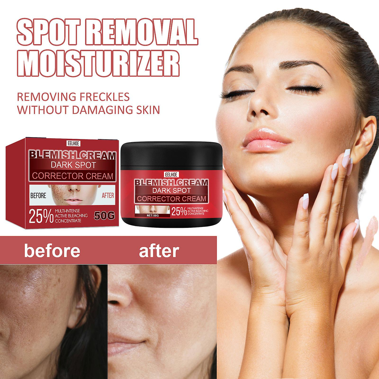 Foto 3 pulgar | Crema Hidratante Huoguo Para Aclarar Las Pecas Del Melasma - Venta Internacional.