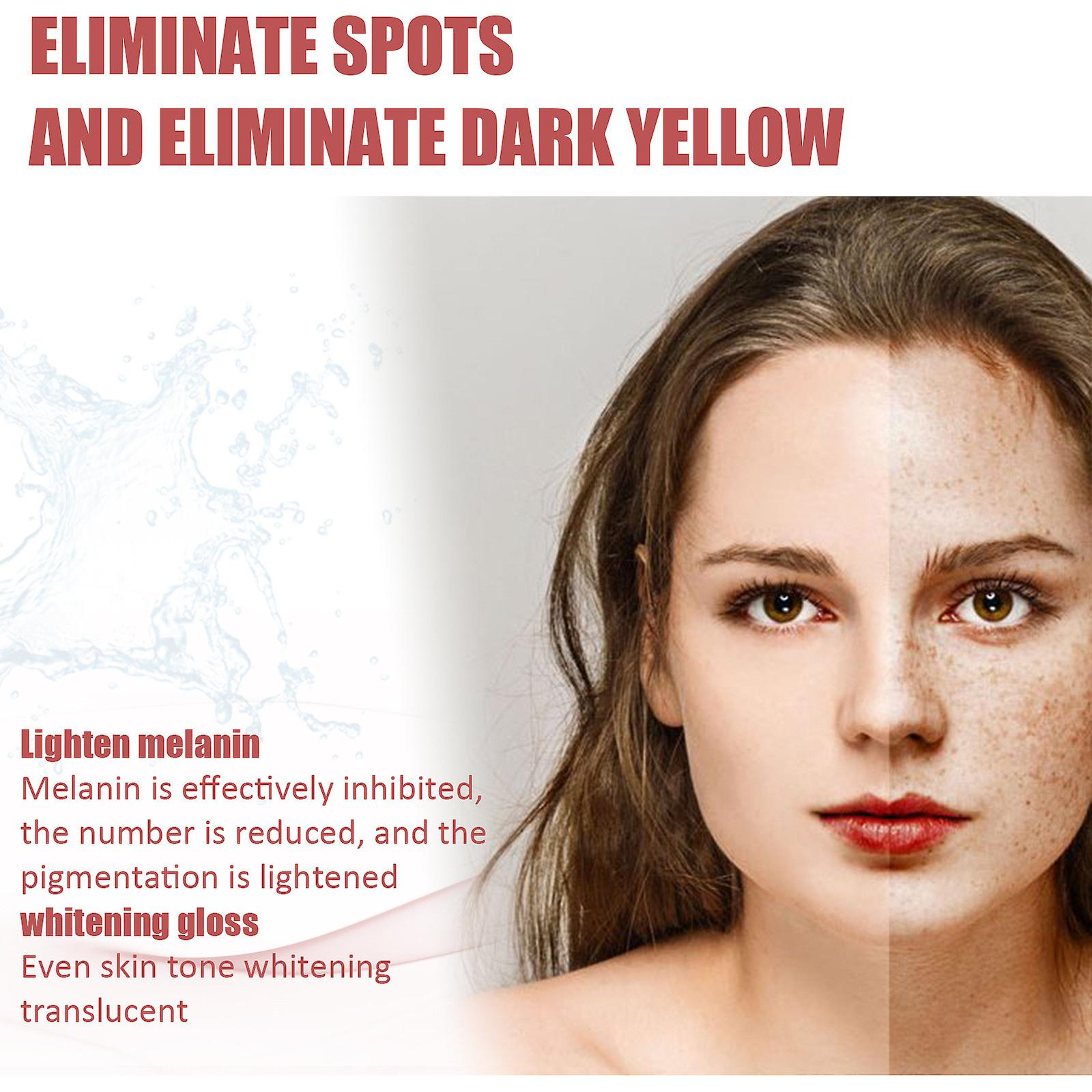 Foto 5 pulgar | Crema Hidratante Huoguo Para Aclarar Las Pecas Del Melasma - Venta Internacional.