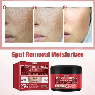 Foto 5 | Crema Hidratante Huoguo Para Aclarar Las Pecas Del Melasma - Venta Internacional.