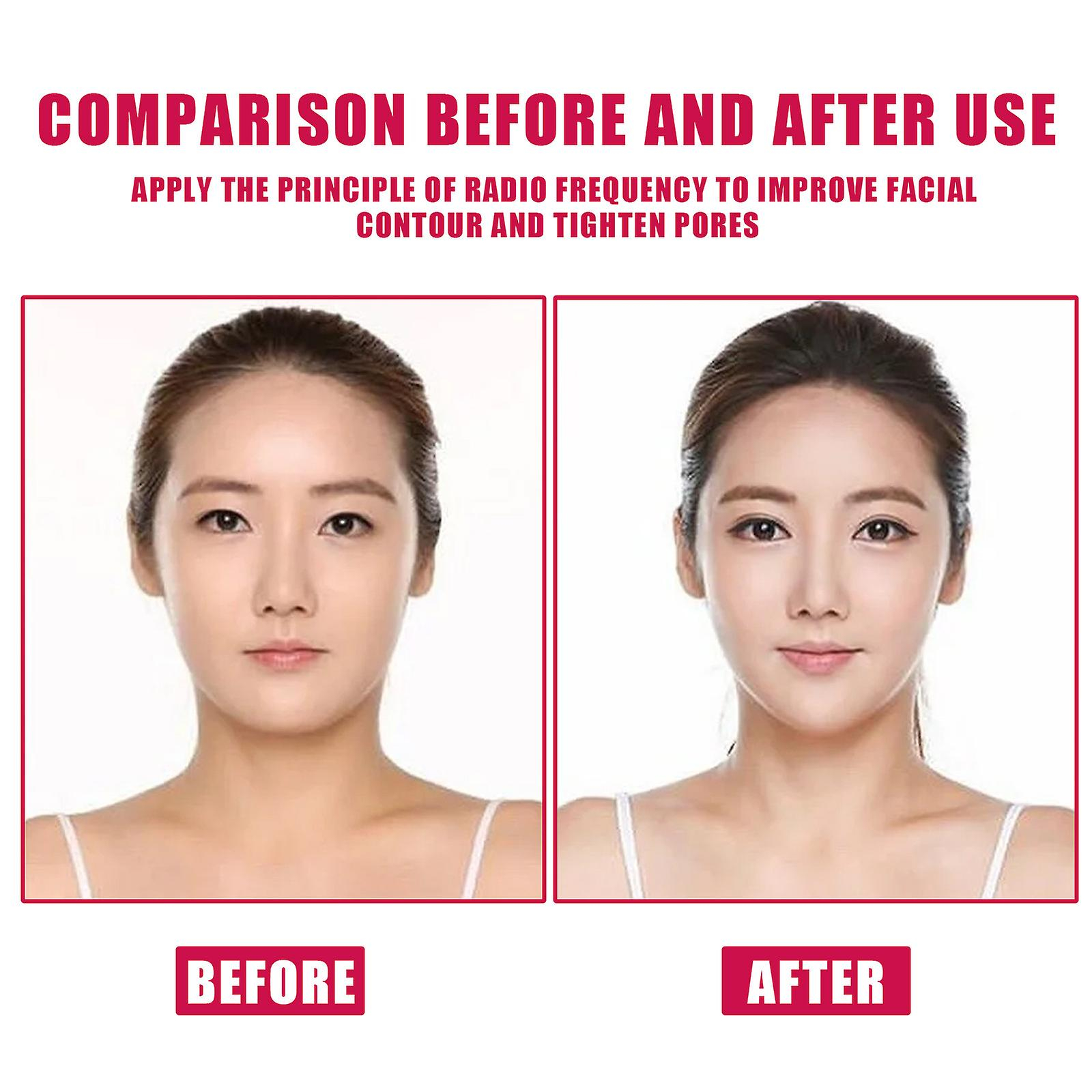 Foto 6 pulgar | Aceite Reafirmante Facial Huoguo Reduce Las Líneas Finas 30 Ml - Venta Internacional.
