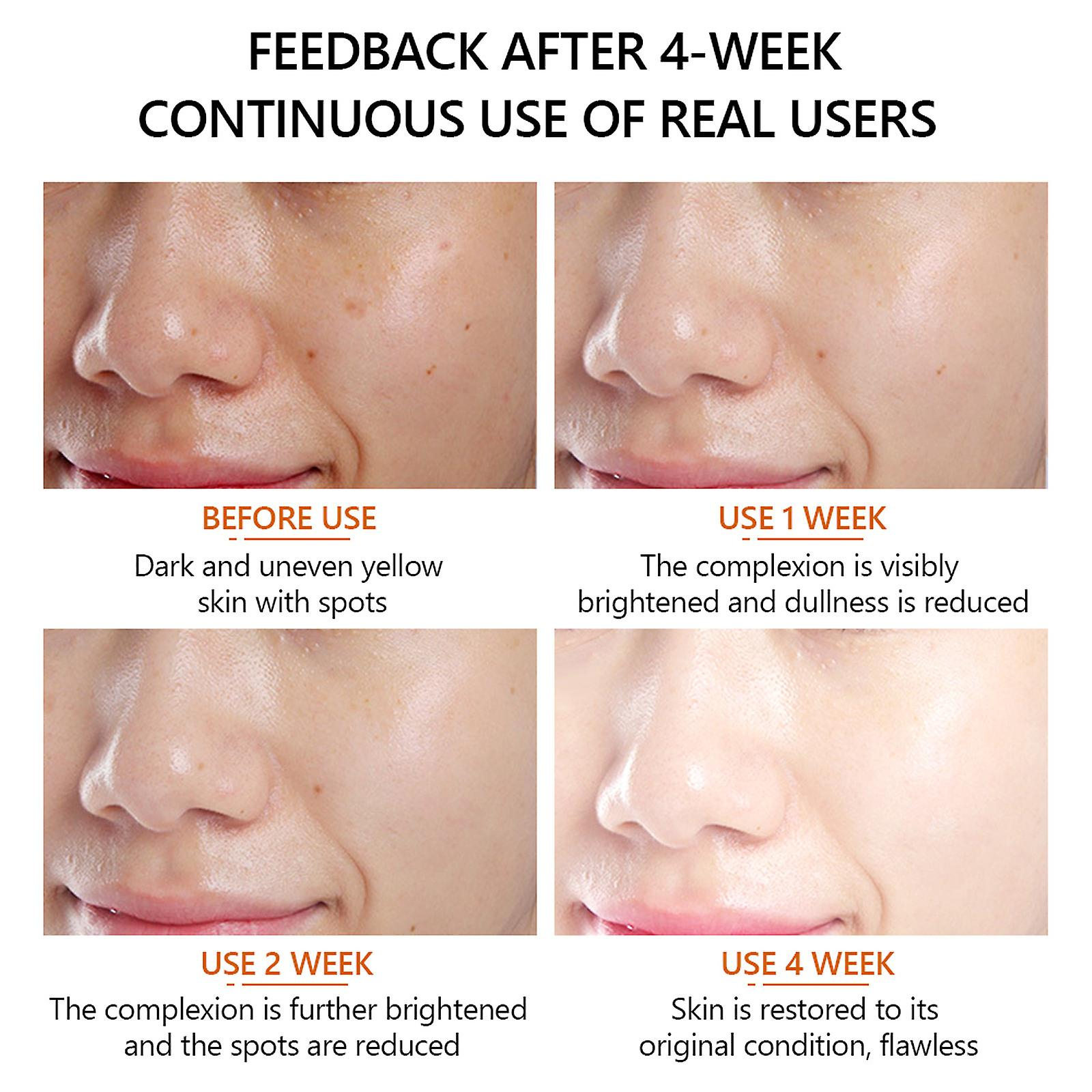 Foto 1 | Facial Essence Huoguo Vitamina C  30 Ml  Para Iluminar La Piel - Venta Internacional.