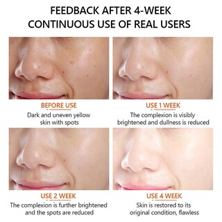 Foto 1 | Facial Essence Huoguo Vitamina C 30 Ml Para Iluminar La Piel - Venta Internacional.