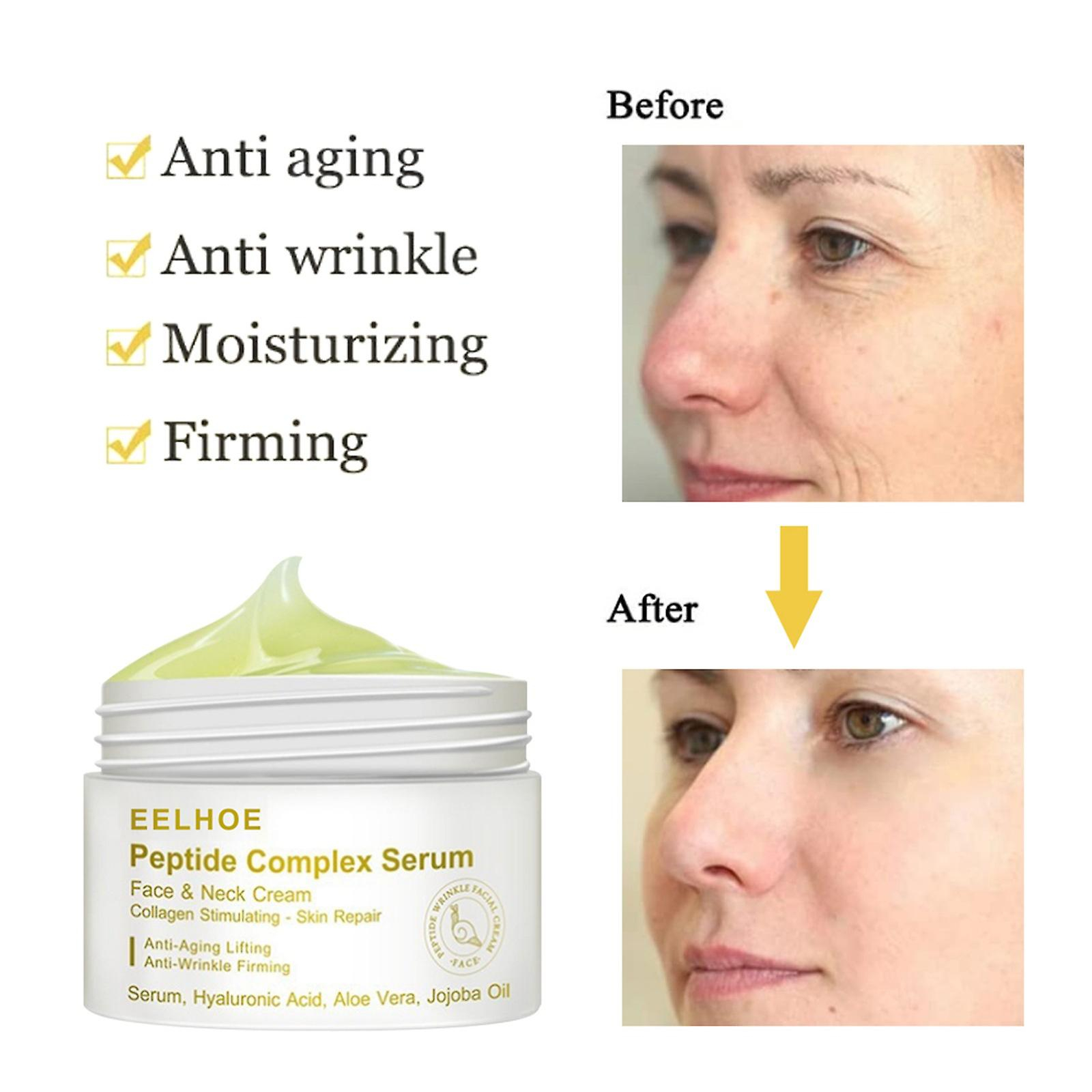 Foto 5 pulgar | Crema Facial Huoguo Efectiva Para Blanquear La Mañana  25 Ml  Unisex - Venta Internacional.