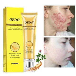 Foto 2 | Crema Blanqueadora Para El Cuidado Facial Oedo Repair Acne 20 Ml Con Ginseng - Venta Internacional.