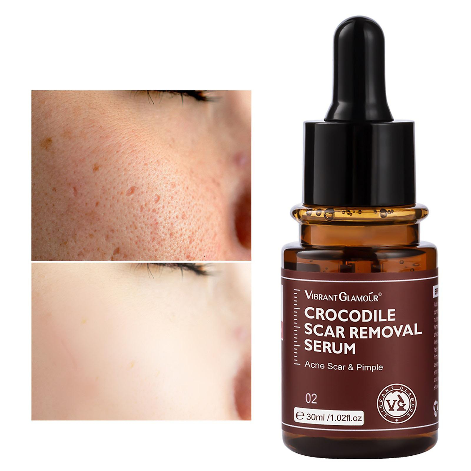 Foto 3 pulgar | Facial Essence Huoguo Hidratante Para Piel Amarilla Oscura - Venta Internacional.