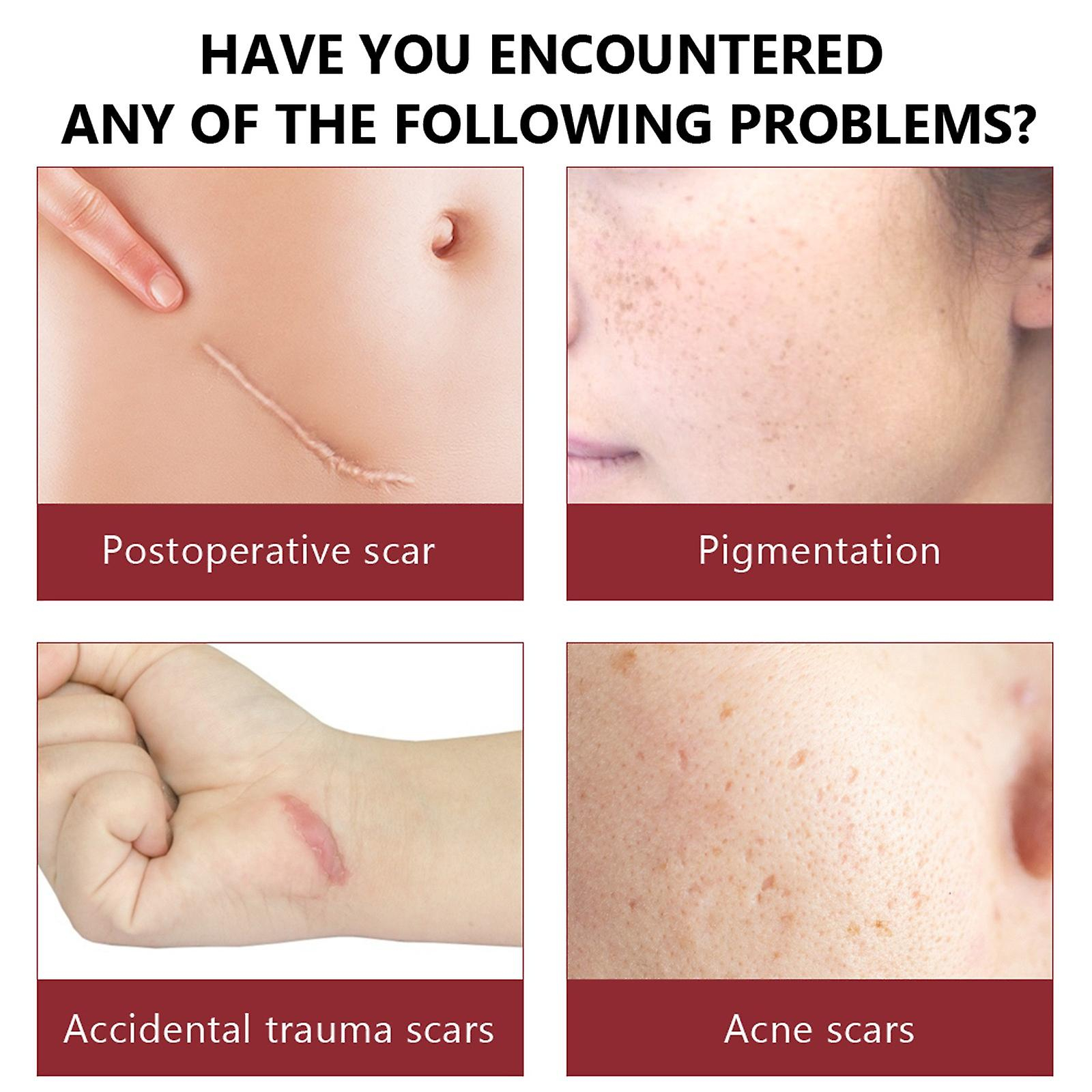 Foto 4 pulgar | Facial Essence Huoguo Hidratante Para Piel Amarilla Oscura - Venta Internacional.