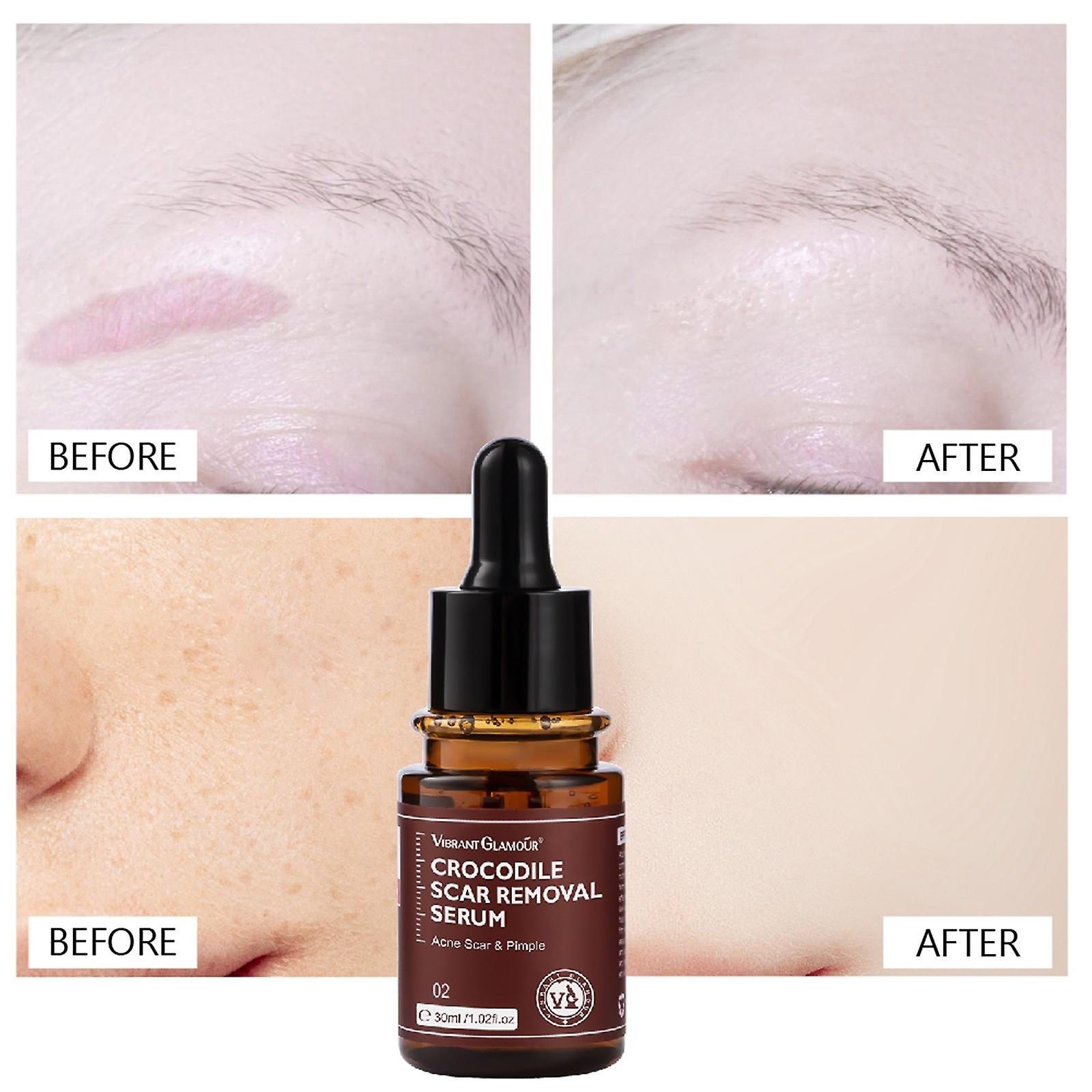 Foto 5 pulgar | Facial Essence Huoguo Hidratante Para Piel Amarilla Oscura - Venta Internacional.
