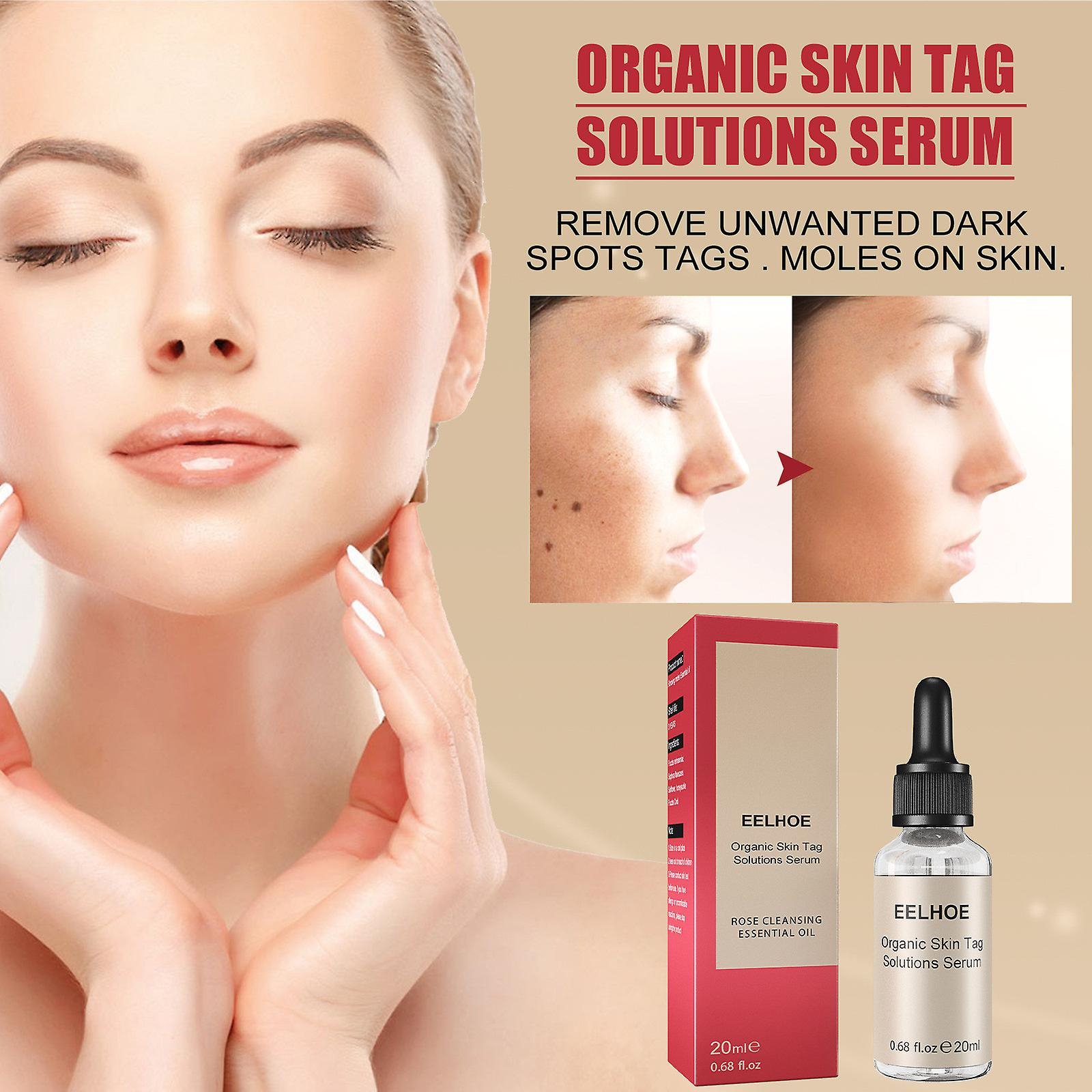 Foto 3 pulgar | Syrup Essence No Black Mole  20 Ml  Elimina Y Repara La Piel Decolorada - Venta Internacional.
