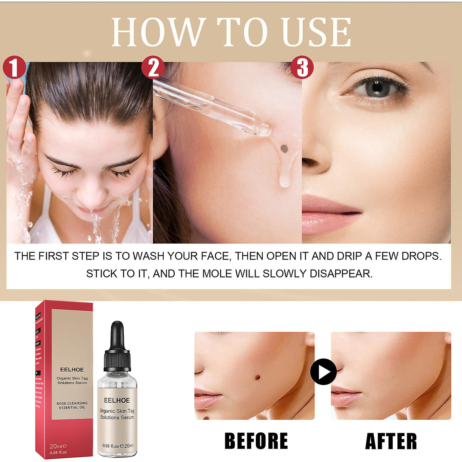 Foto 5 pulgar | Syrup Essence No Black Mole  20 Ml  Elimina Y Repara La Piel Decolorada - Venta Internacional.