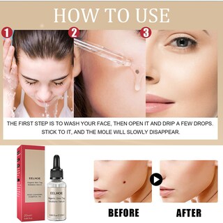 Foto 4 | Syrup Essence No Black Mole 20 Ml Elimina Y Repara La Piel Decolorada - Venta Internacional.