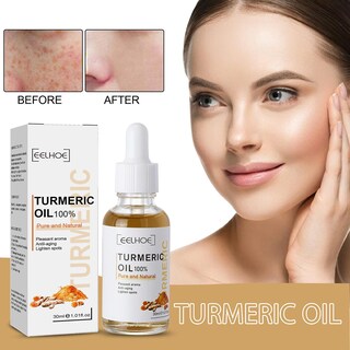Foto 2 | Sérum Corrector De Manchas Oscuras Con Cúrcuma 30 Ml Alto Brillo Para El Cuidado De La Piel - Venta Internacional.